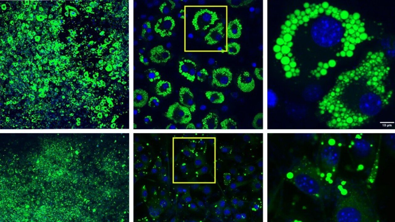 Individuata una proteina che accelera il metabolismo dei grassi Individuata una proteina che accelera il metabolismo dei grassi