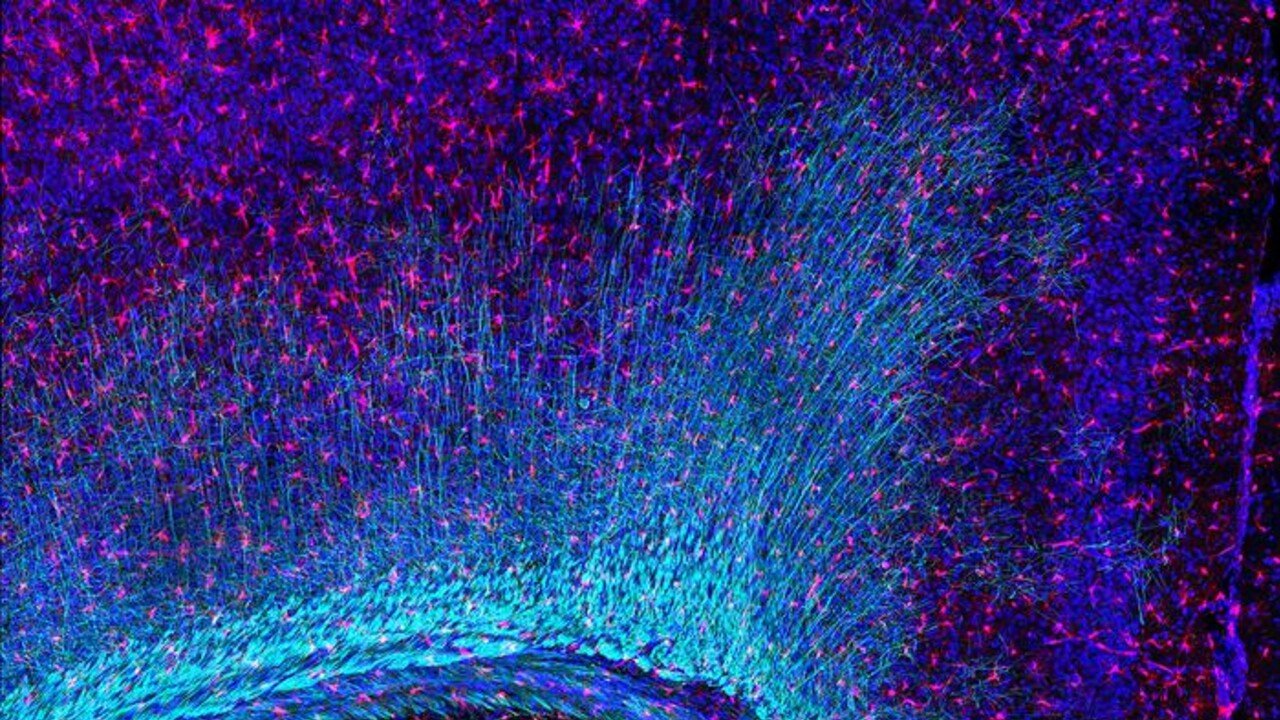 Nei custodi del cervello il motore delle malattie neurologiche Nei custodi del cervello il motore delle malattie neurologiche