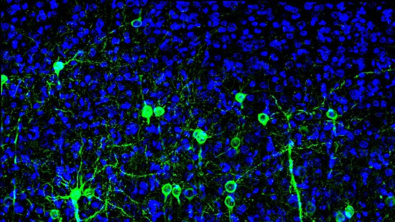Nel cervello prevalgono i neuroni tuttofare